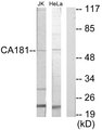 ZNHIT6 / C1orf181 Antibody - Western blot analysis of lysates from Jurkat and HeLa cells, using CA181 Antibody. The lane on the right is blocked with the synthesized peptide.