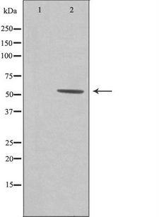 ZNHIT6 / C1orf181 Antibody - Western blot analysis of extracts of Jurkat cells using CA181 antibody. The lane on the left is treated with the antigen-specific peptide.