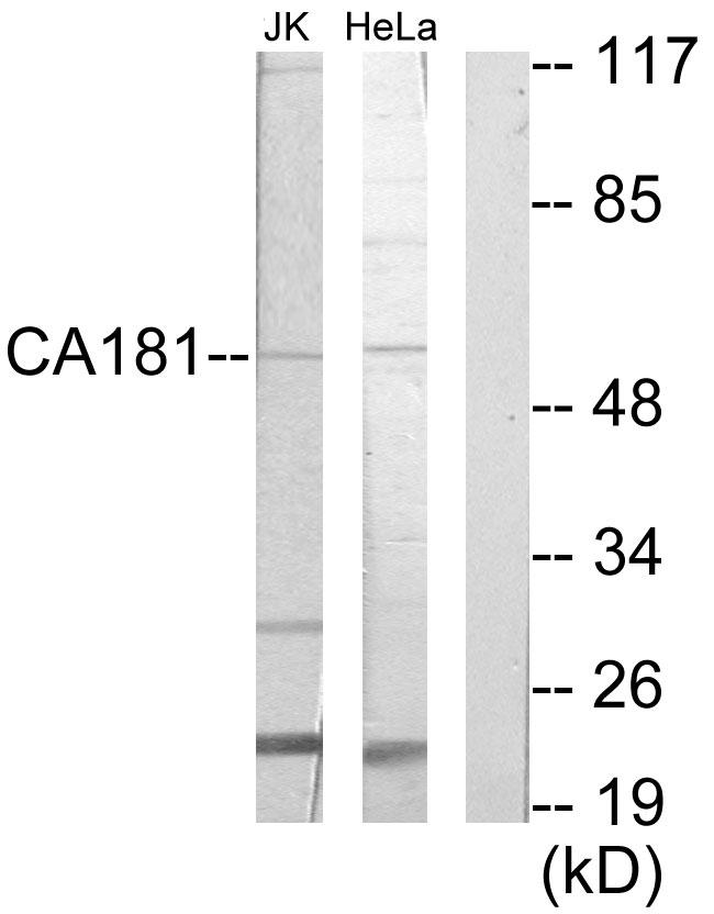 ZNHIT6 / C1orf181 Antibody - Western blot analysis of extracts from Jurkat cells and HeLa cells, using CA181 antibody.