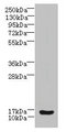 ZNRD1 Antibody - Western blot All lanes: ZNRD1 antibody at 14µg/ml + Human high value serum Secondary Goat polyclonal to rabbit IgG at 1/10000 dilution Predicted band size: 14 kDa Observed band size: 14 kDa