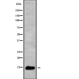 ZNRD1 Antibody - Western blot analysis of ZNRD1 using HuvEc whole cells lysates