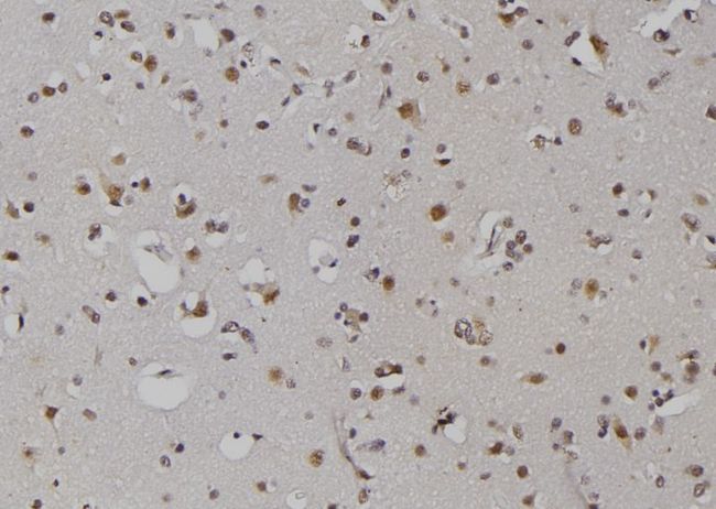 ZNRD1 Antibody - 1:100 staining human brain tissue by IHC-P. The sample was formaldehyde fixed and a heat mediated antigen retrieval step in citrate buffer was performed. The sample was then blocked and incubated with the antibody for 1.5 hours at 22°C. An HRP conjugated goat anti-rabbit antibody was used as the secondary.