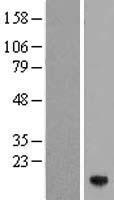 ZNRD1 Protein - Western validation with an anti-DDK antibody * L: Control HEK293 lysate R: Over-expression lysate