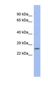 ZNRF1 Antibody - ZNRF1 antibody Western blot of Fetal Spleen lysate. This image was taken for the unconjugated form of this product. Other forms have not been tested.