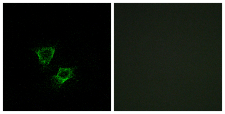 ZNRF2 Antibody - Immunofluorescence analysis of A549 cells, using ZNRF2 Antibody. The picture on the right is blocked with the synthesized peptide.