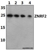 ZNRF2 Antibody - Western blot of TRAPPC6A antibody at 1:500 dilution. Lane 1: HEK293T whole cell lysate (40 ug). Lane 2: H9C2 whole cell lysate (40 ug). Lane 3: RAW264.7 whole cell lysate (40 ug). Lane 4: A549 whole cell lysate (40 ug).