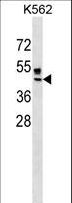 ZNRF4 Antibody - ZNRF4 Antibody western blot of K562 cell line lysates (35 ug/lane). The ZNRF4 Antibody detected the ZNRF4 protein (arrow).