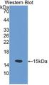 ZNT5 / SLC30A5 Antibody - Western blot of ZNT5 / SLC30A5 antibody.