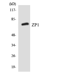 ZP1 Antibody - Western blot analysis of the lysates from HeLa cells using ZP1 antibody.