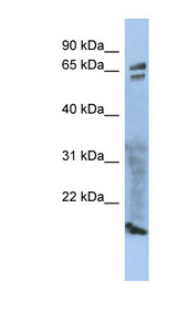 ZP1 Antibody - ZP1 antibody Western blot of 293T cell lysate. This image was taken for the unconjugated form of this product. Other forms have not been tested.