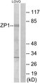 ZP1 Antibody - Western blot analysis of lysates from LOVO cells, using ZP1 Antibody. The lane on the right is blocked with the synthesized peptide.