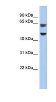 ZP1 Antibody - ZP1 antibody Western blot of 293T cell lysate. This image was taken for the unconjugated form of this product. Other forms have not been tested.