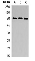 ZP1 Antibody - Western blot analysis of ZP1 expression in HepG2 (A); LOVO (B); KNRK (C) whole cell lysates.