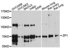 ZP1 Antibody - Western blot analysis of extracts of various cell lines, using ZP1 antibody at 1:1000 dilution. The secondary antibody used was an HRP Goat Anti-Rabbit IgG (H+L) at 1:10000 dilution. Lysates were loaded 25ug per lane and 3% nonfat dry milk in TBST was used for blocking. An ECL Kit was used for detection and the exposure time was 90s.