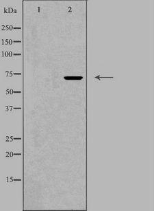 ZP1 Antibody - Western blot analysis of extracts of LOVO cells using ZP1 antibody. The lane on the left is treated with the antigen-specific peptide.