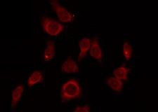 ZP1 Antibody - Staining LOVO cells by IF/ICC. The samples were fixed with PFA and permeabilized in 0.1% Triton X-100, then blocked in 10% serum for 45 min at 25°C. The primary antibody was diluted at 1:200 and incubated with the sample for 1 hour at 37°C. An Alexa Fluor 594 conjugated goat anti-rabbit IgG (H+L) Ab, diluted at 1/600, was used as the secondary antibody.