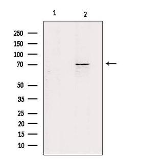 ZP1 Antibody - Western blot analysis of extracts of mouse kidney using ZP1 antibody. Lane 1 was treated with the antigen-specific peptide.