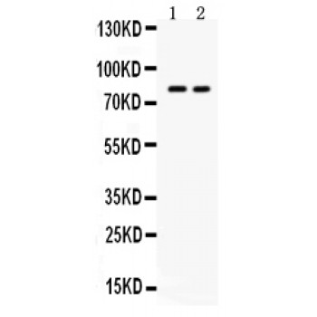 ZP2 Antibody - Western blot analysis of ZP2 expression in HELA whole cell lysates (lane 1) and HEPG2 whole cell lysates (lane 2). ZP2 at 82 kD was detected using rabbit anti- ZP2 Antigen Affinity purified polyclonal antibody at 0.5 ug/mL. The blot was developed using chemiluminescence (ECL) method.