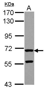ZP2 Antibody - Sample (30 ug of whole cell lysate) A: IMR32 7.5% SDS PAGE ZP2 antibody diluted at 1:1000