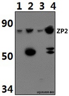 ZP2 Antibody - Western blot of ZP2 mAb at 1:500 dilution. Lane 1: HeLa whole cell lysate (40 ug).