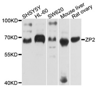 ZP2 Antibody - Western blot analysis of extracts of various cell lines, using ZP2 antibody at 1:1000 dilution. The secondary antibody used was an HRP Goat Anti-Rabbit IgG (H+L) at 1:10000 dilution. Lysates were loaded 25ug per lane and 3% nonfat dry milk in TBST was used for blocking. An ECL Kit was used for detection and the exposure time was 10s.