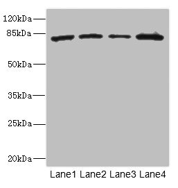 ZP2 Antibody - Western blot All Lanes: ZP2 antibody at 3.06ug/ml Lane 1: 293T whole cell lysate Lane 2: Hela whole cell lysate Lane 3: Jurkat whole cell lysate Lane 4: HepG-2 whole cell lysate Secondary Goat polyclonal to rabbit IgG at 1/10000 dilution Predicted band size: 83,82 kDa Observed band size: 82 kDa