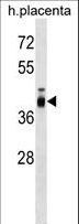 ZP3 Antibody - ZP3 Antibody western blot of human placenta tissue lysates (35 ug/lane). The ZP3 antibody detected the ZP3 protein (arrow).