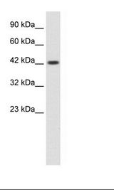 ZP3 Antibody - HepG2 Cell Lysate.  This image was taken for the unconjugated form of this product. Other forms have not been tested.