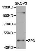 ZP3 Antibody - Western blot analysis of extracts of SKOV3 cells.