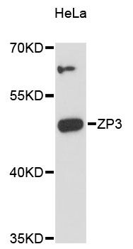ZP3 Antibody - Western blot analysis of extracts of HeLa cells, using ZP3 antibody at 1:3000 dilution. The secondary antibody used was an HRP Goat Anti-Rabbit IgG (H+L) at 1:10000 dilution. Lysates were loaded 25ug per lane and 3% nonfat dry milk in TBST was used for blocking. An ECL Kit was used for detection and the exposure time was 90s.