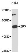 ZP3 Antibody - Western blot analysis of extracts of HeLa cells, using ZP3 antibody at 1:3000 dilution. The secondary antibody used was an HRP Goat Anti-Rabbit IgG (H+L) at 1:10000 dilution. Lysates were loaded 25ug per lane and 3% nonfat dry milk in TBST was used for blocking. An ECL Kit was used for detection and the exposure time was 90s.