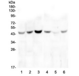 ZP3 Antibody - Western blot testing of human 1) HeLa, 2) placenta, 3) A549, 4) T-47D, 5) PC-3 and 6) U-2 OS cell lysate with ZP3 antibody at 0.5ug/ml. Predicted molecular weight ~47 kDa.