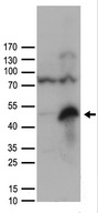 ZP3 Antibody - HEK293T cells were transfected with the pCMV6-ENTRY control. (Left lane) or pCMV6-ENTRY ZP3. (Right lane) cDNA for 48 hrs and lysed