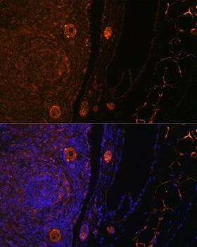 ZP3 Antibody - Immunofluorescence analysis of Rat oophoroma cells using ZP3 Polyclonal Antibody at dilution of 1:100.Blue: DAPI for nuclear staining.