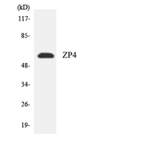 ZP4 / ZBP Antibody - Western blot analysis of the lysates from HepG2 cells using ZP4 antibody.