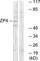 ZP4 / ZBP Antibody - Western blot analysis of lysates from Jurkat cells, using ZP4 Antibody. The lane on the right is blocked with the synthesized peptide.