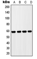 ZP4 / ZBP Antibody - Western blot analysis of ZP4 expression in HepG2 (A); HeLa (B); NIH3T3 (C); H9C2 (D) whole cell lysates.