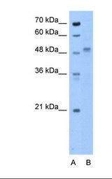 ZP4 / ZBP Antibody - Lane A: Marker. Lane B: HepG2 cell lysate. Antibody concentration: 0.5 ug/ml. Gel concentration: 12%.  This image was taken for the unconjugated form of this product. Other forms have not been tested.