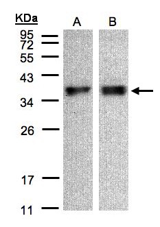 ZPBP / SP38 Antibody - Sample (30 ug of whole cell lysate). A: A431, B: HeLa S3. 12% SDS PAGE. ZPBP / SP38 antibody diluted at 1:500