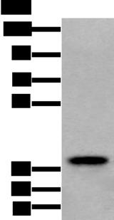 ZPBP / SP38 Antibody - Western blot analysis of Human testis tissue lysate  using ZPBP Polyclonal Antibody at dilution of 1:250