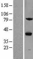 ZPBP / SP38 Protein - Western validation with an anti-DDK antibody * L: Control HEK293 lysate R: Over-expression lysate
