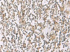 ZPBP2 Antibody - Immunohistochemistry of paraffin-embedded Human tonsil tissue  using ZPBP2 Polyclonal Antibody at dilution of 1:80(×200)