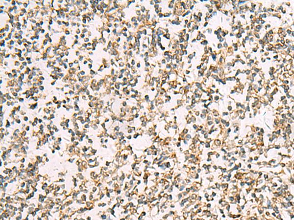 ZPBP2 Antibody - Immunohistochemistry of paraffin-embedded Human tonsil tissue  using ZPBP2 Polyclonal Antibody at dilution of 1:50(×200)