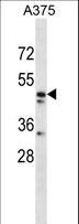 ZPR1 / ZNF259 Antibody - ZNF259 Antibody western blot of A375 cell line lysates (35 ug/lane). The ZNF259 antibody detected the ZNF259 protein (arrow).