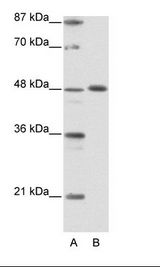 ZPR1 / ZNF259 Antibody - A: Marker, B: Jurkat Cell Lysate.  This image was taken for the unconjugated form of this product. Other forms have not been tested.