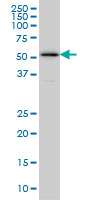 ZPR1 / ZNF259 Antibody - ZNF259 monoclonal antibody (M01), clone 6F7 Western blot of ZNF259 expression in Jurkat.