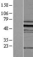 ZPR1 / ZNF259 Protein - Western validation with an anti-DDK antibody * L: Control HEK293 lysate R: Over-expression lysate