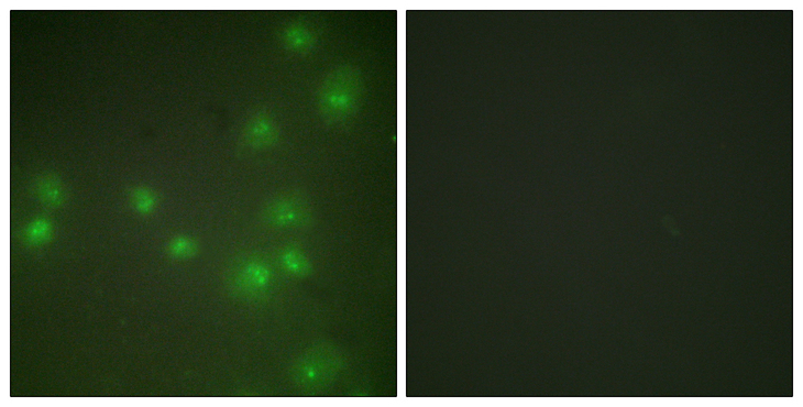 ZRANB2 / ZNF265 Antibody - Immunofluorescence analysis of HUVEC cells, using ZNF265 Antibody. The picture on the right is blocked with the synthesized peptide.