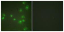 ZRANB2 / ZNF265 Antibody - Immunofluorescence analysis of HUVEC cells, using ZNF265 Antibody. The picture on the right is blocked with the synthesized peptide.