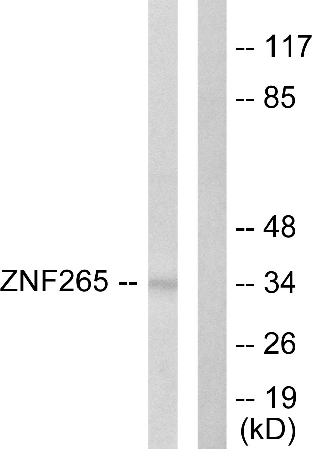 ZRANB2 / ZNF265 Antibody - Western blot analysis of lysates from HeLa cells, using ZNF265 Antibody. The lane on the right is blocked with the synthesized peptide.